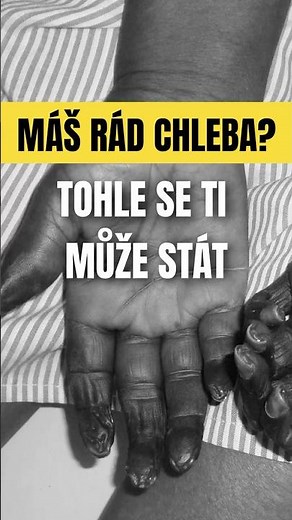 Jedna Várka Špatného Chleba Zlikvidovala Celou Vesnici