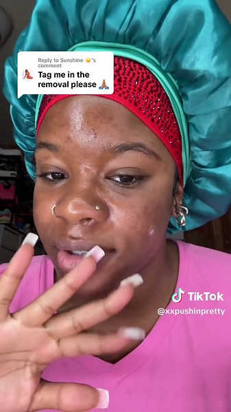 Pimple Patch Removal Process and Results