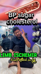Chronic limb ischemia! 🩺 For managing this condition, leg exercises are crucial 🏋️‍♀️. *Must-do leg exercises include:* - *Walking*: Regular short walks to improve circulation 🚶‍♂️ - *Toe raises*: Strengthen calf muscles 👣 - *Leg lifts*: Improve muscle strength and flexibility 💪 These exercises can help alleviate symptoms and improve limb function 🔄. Consult a healthcare professional for a personalized exercise plan 👨‍⚕️.#drramphysio #pain #blood #therapy #healthy #life #lifestyle #fit | 