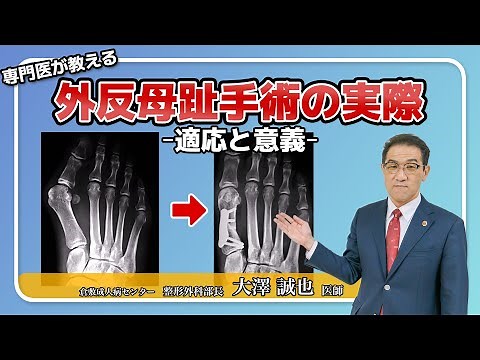 外反母趾手術の実際～適応と意義～