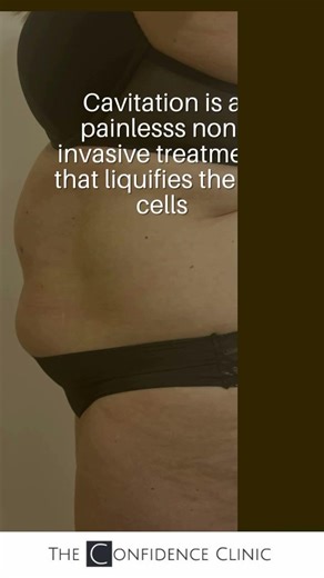 3D Lipo Cavitation & Pressotherapy #3D Lipo Cavitation #Pressotherapy #medicalaesthetics