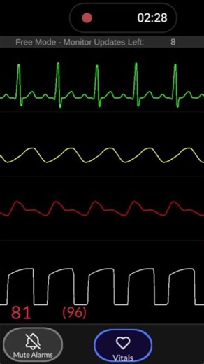 Simpl Patient Monitor