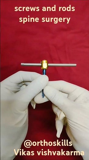screws and rods in spine surgery.rods and screws.monoaxial Screw.Polyaxial screw.Spine screw.#spine