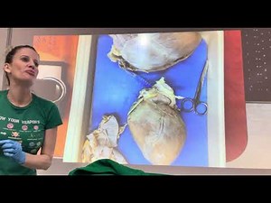 Heart Dissection for APII Lab