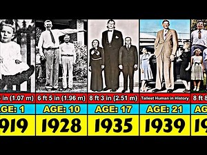 Robert Wadlow Transformation From 1 to 22 Year Old