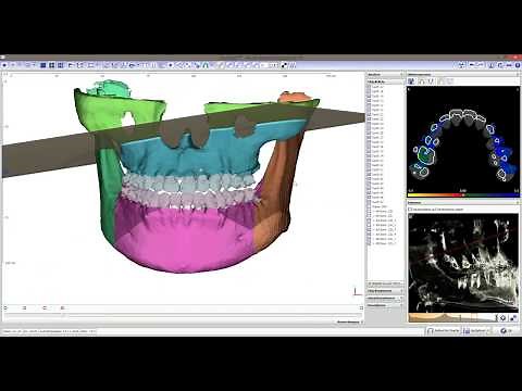 OnyxCeph³™ - All-In-One Orthodontic Imaging Software