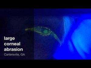large corneal abrasion