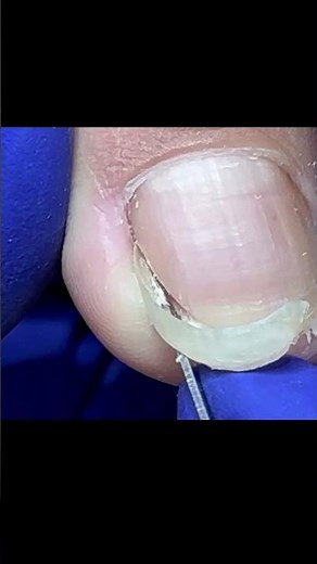 Satisfying pedicure video! #pedicure #toenails #satisfying #nails