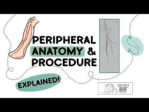 PERIPHERAL Anatomy & RunOff Angiogram 101 | ABOVE and BELOW the knee