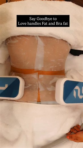 Dr.Swapna Komaragiri on Instagram: "762-202-7777, 706-903-0777, 762-202-7777, 706-903-0777 Freeze away your love handles fat Without surgery and injectables 50% off till Jan 5th to Jan 10th Dr.Sapna is available at Surat vesu clinic Our Branches Surat and Vapi Gujarat Book Now Bookings are filling up #fatloss #slimming #weightloss #surat #mumbai"