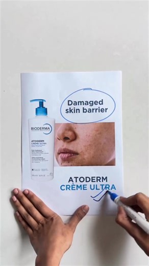 ✨ Say Goodbye to Dry Skin with Atoderm Cream Ultra! ✨ Experience 48-hour intense hydration and silky-soft skin with Bioderma's Atoderm Cream Ultra – perfect for sensitive, dry, or very dry skin. 💧 Ultra-nourishing 💧 Non-greasy & fast-absorbing 💧 Strengthens your skin’s natural barrier Dermatologist-recommended and safe for the whole family 👨‍👩‍👧‍👦 Healthy skin starts here — nourish, protect, and glow naturally! 💙 For Order : ☎️ Hotline:16572 💌 Order from Messenger: https://www.facebook.