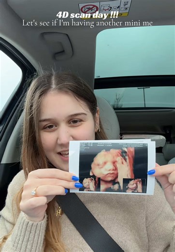 Exciting 4D Scan Day: Baby No. 2 on the Way!