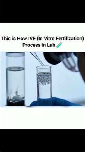 ivf procedure step by step #ivf #ivftreatment #shorts #viral