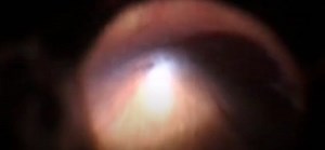 Testing a Cryotherapy Machine - Eyetube