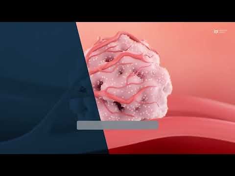 c-MYC: A master regulator of breast cancer cells and the tumor microenvironment