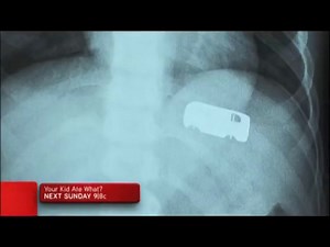 TLC - Your Kid Ate What?