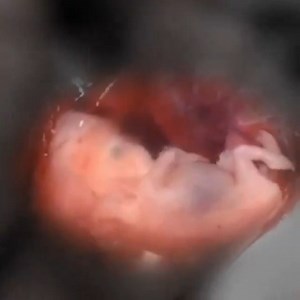 3.5M views · 101K reactions | This is a baby just 8 weeks from fertilization. Not a clump of cells, but a human being deserving of life. | Live Action | Facebook