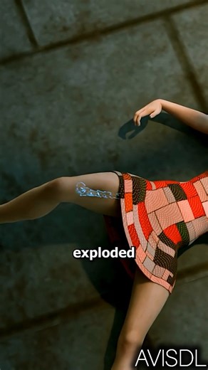 Avis DL on Instagram: "Surviving 39 Broken Bones… The Miracle Story 🦴✨#survivalstory #avisdl"