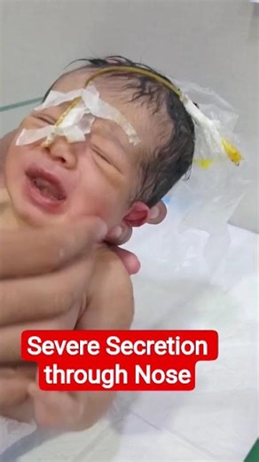 Baby with Severe Secretions Through Nose