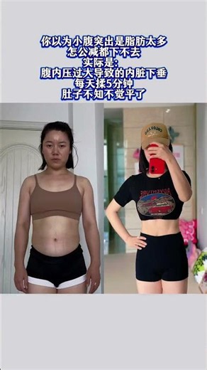 Banish the Bulge: Fixing a Sagging Lower Abdomen Fast