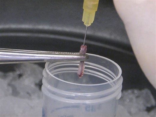 In vivo Clonal Tracking of Hematopoietic Stem and Progenitor Cells Marked by Five Fluorescent Proteins using Confocal and Multiphoton Microscopy