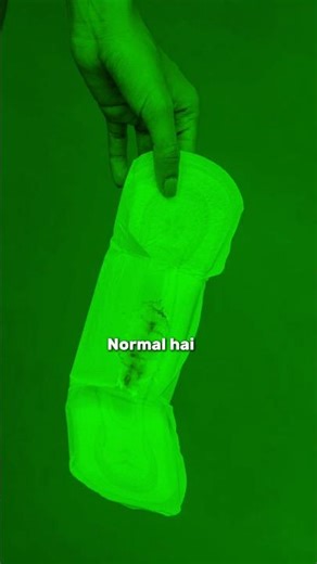 White Discharge: Normal or Infection? | Doctor Explains #whitedischarge #doctorreels #yt #doctor