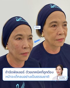 7.9K reactions · 181 shares | พิสูจน์ด้วยตาในคลิป !!...