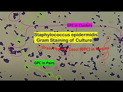 Gram Positive Cocci (GPC) in Singles, Pairs and Clusters in Gram Staining of Culture Microscopy