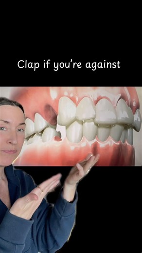 Please don’t extract and retract! In most cases, you can expand the and make room for your teeth!