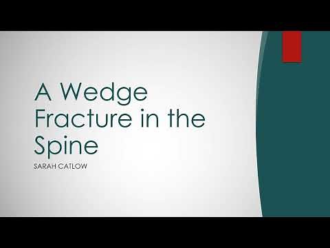 Understanding Wedge Fracture in the Spine | Sports Therapy Overview