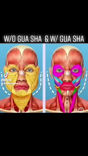 If you’re not using this method— YOU NEED TO TRY! #skincare #kit #replacing #botox #filterlessera