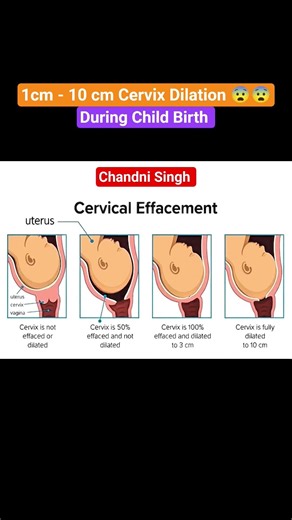 How the Cervix Opens During Labor | 0 to 10 cm Explained #viralshort #viralreels #shortfeed #shorts