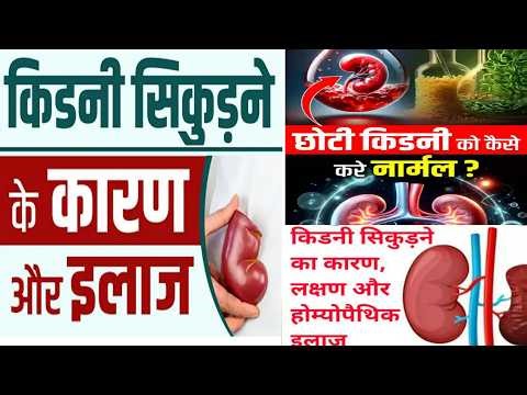 Kidney Shrinkage Best Homoeopathic Medicine//Kidney Atrophy Ki Best Homoeopathic Medicine//By: HM4U.