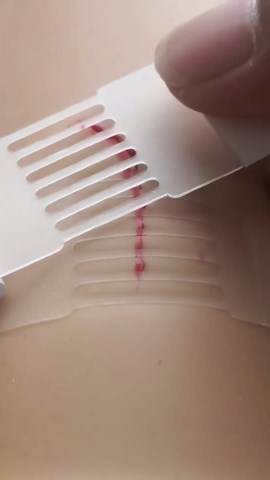 Emergency Wound Closure Strips - HSA/FSA Eligible - Dotodo 4PCS Laceration Closure Kit - Sutures Butterfly Bandaids | Stretchable & Shrinks Back to Close The Cut