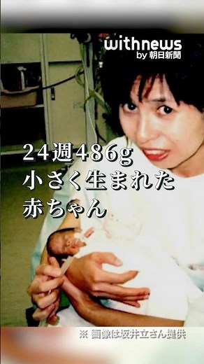 24 years ago, I was a "tiny baby" born at 24 weeks and 486g #ExtremelyLowBirthWeightInfant
