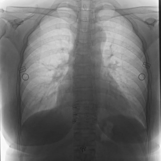 Chest X-ray Fluoroscopy #fujifilm #hospital #xraytechnician #medicalequipment #medicalimaging #dr
