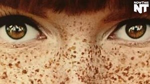 401K views · 4.1K reactions | The internet is pissed that Match.com’s ad called freckles ‘imperfections’ | NowThis | Facebook