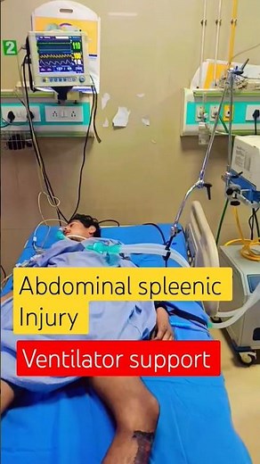 The Anatomy of a Spleen Injury || causes || symptoms || treatment