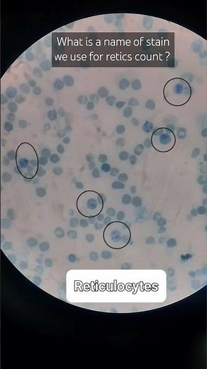 Reticulocytes count #hematology #microscopy #pathology