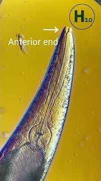 Swimming in ACID?! Meet Vinegar Eels