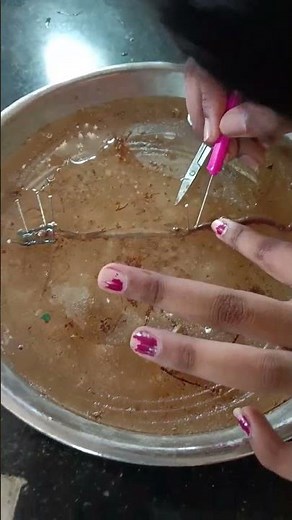 dissection of earthworm #dissection#earthworm #sciencefacts #anatomy #zoológico #earthworms