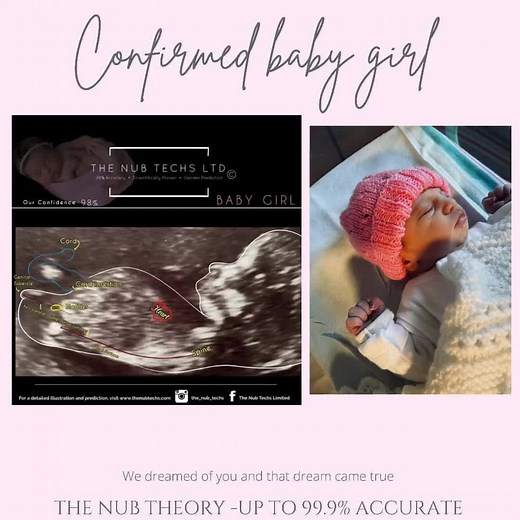 Gender Reveal Methods: Nub Theory Explained