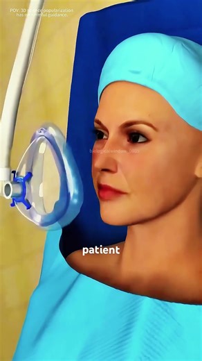 Pectus Excavatum And Nuss Procedure (3D animation) #music #motivation #epic #like