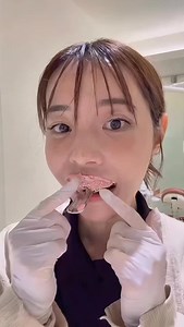 63 reactions · 54 shares | AI digital dental impressions are starting to get seriously bizarre. @dentaltown Impressions https://www.dentaltown.com/messageboard/thread.aspx?s=2&f=136&t=365829&g=1&st=Impressions | Howard Farran DDS, MBA | Facebook