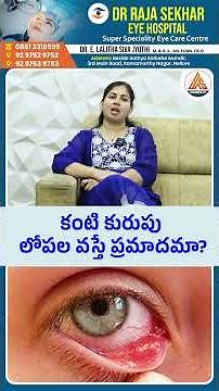 Eye Stye Inside Eyelid? 😱 Don’t Ignore This! | Doctor Advice 👁️ | SASTv