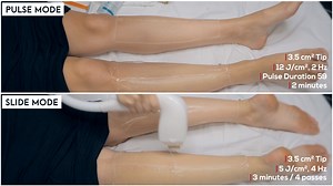 1.2K views · 13 reactions | With Venus Velocity™, patient safety and...