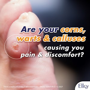 Ellgy Corns & Warts Treatment Solution is formulated with Salicylic Acid - easy and effective! For the topical treatment of corns, warts, and calluses. Available at your nearest pharmacy, Watsons and Guardian stores. #EllgyPlusMY #EllgyCornsAndWartsTreatmentSolution | Ellgy Plus Malaysia