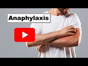Tips for Anaphylaxis Management