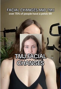 TMJ & Pelvic Tilt: Improving Facial Asymmetry and Pain