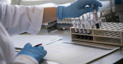 COVID long-haulers call for better research into their conditions